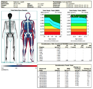Visceral fat and bone density